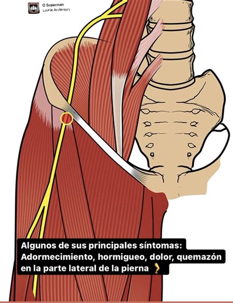 meralgia parestésica na gravidez|Meralgia Paresthetica: Pregnancy, Causes, Home。